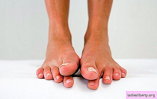 Why the joints of the big toes hurt: a serious symptom. Who to contact for pain in the joint of the big toe