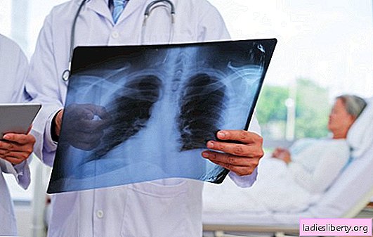Kadınlar neden erkeklerden daha fazla akciğer kanseri geçiriyor?