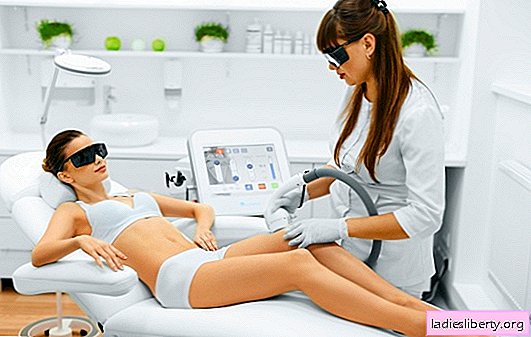 The benefits of laser hair removal: key points. Why can laser hair removal be harmful?