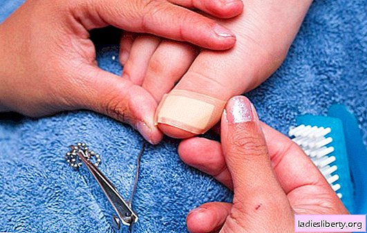 Will treating an ingrown nail with folk remedies at home? Expert opinion on alternative methods of treatment of onychocryptosis
