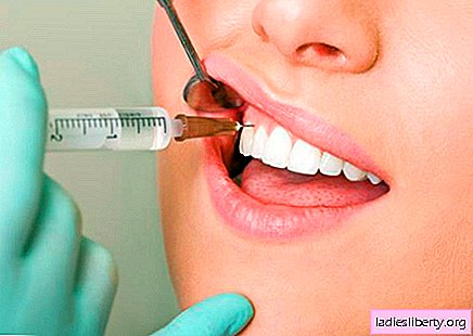 Procédures dentaires populaires: cela vaut-il la peine?