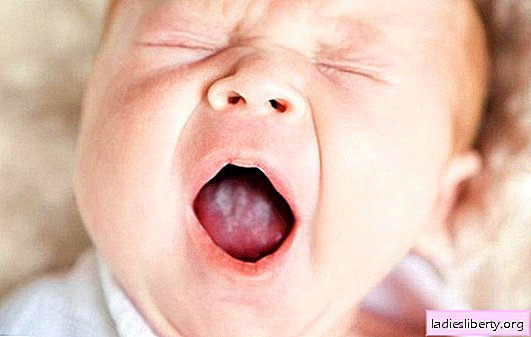 O aparecimento de aftas na boca em recém-nascidos e seu tratamento. Como diagnosticar sapinho na boca de um recém-nascido e qual pode ser o tratamento da doença
