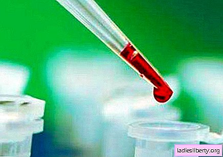 Tearful method of blood sampling in children