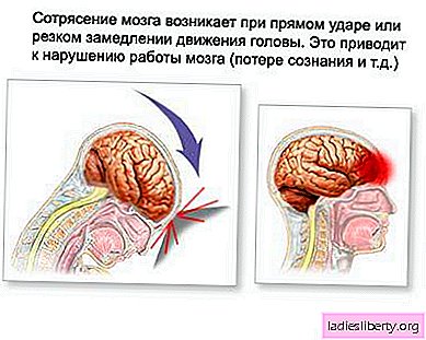 Conmoción cerebral: causas, síntomas, diagnóstico, tratamiento.