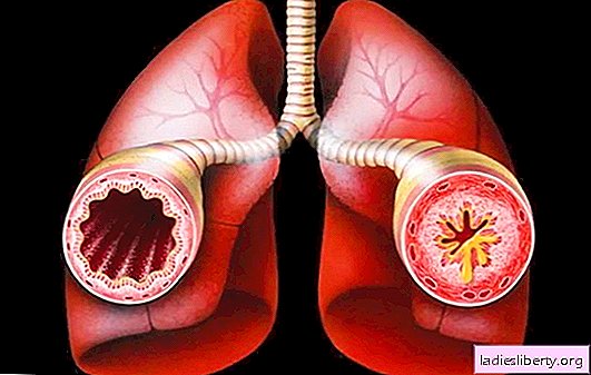 Spasmen van de bronchiën: wat draagt ​​bij aan de ontwikkeling van de ziekte? Hoe zelfstandig te helpen met bronchospasme bij volwassenen en kinderen