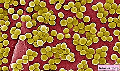 Staphylococcus aureus - causas, síntomas, diagnóstico, tratamiento