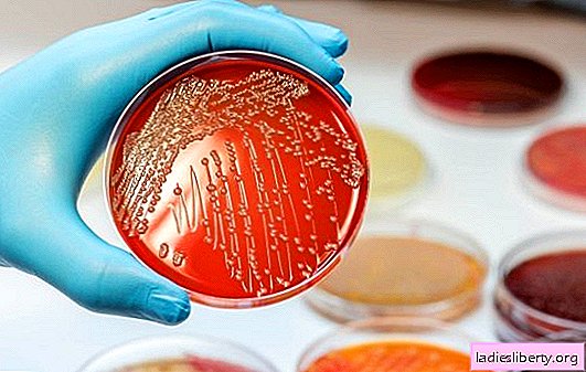 E. coli toksīns izraisa resnās zarnas vēzi: jaunu pētījumu rezultāti un ieteikumi profilaksei