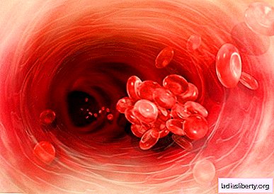 تجلط الدم - الأسباب والأعراض والتشخيص والعلاج