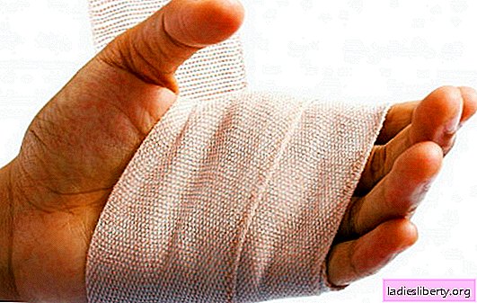 يد مصابة - التشخيص مختلط! الأيدي المصابة - ما يجب القيام به في اللحظات الأولى وكيفية علاجها في المنزل: نصيحة الطبيب