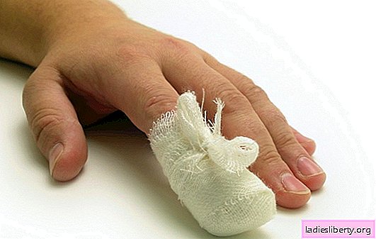 Modreni nokat na ruci ili ne nozi: što učiniti u prvim minutama, kako spasiti nokat? Što će pomoći kod modrica na noktima i kako izbjeći komplikacije