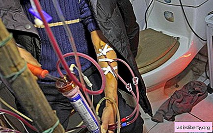 En Chine, le pauvre homme a lui-même conçu un appareil de dialyse
