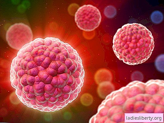 Papilloma virus in women: causes, symptoms, possible consequences. Methods for the treatment of papilloma virus in women