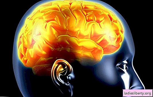 Inflamação do cérebro: causas, sintomas. Tratamentos para inflamação do revestimento do cérebro