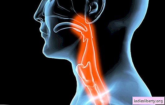 Inflammation of the esophagus: causes, symptoms, possible complications. Methods of treatment of inflammation of the esophagus, prevention