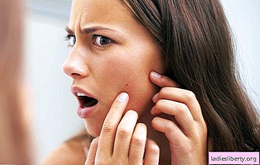 Inflammation of the sebaceous glands: causes, symptoms. Methods for the treatment of inflammation of the sebaceous glands, preventive measures