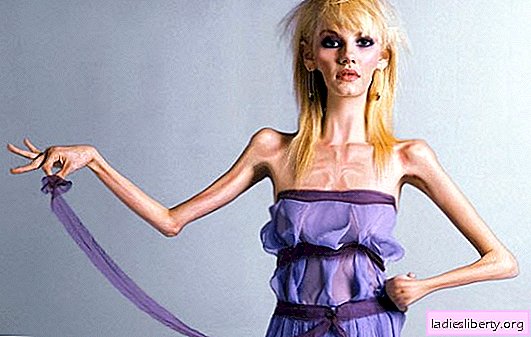 Lehetséges otthon anorexia kezelése? Mit kell tudni az anorexiaról és az otthoni kezelés jellemzőiről